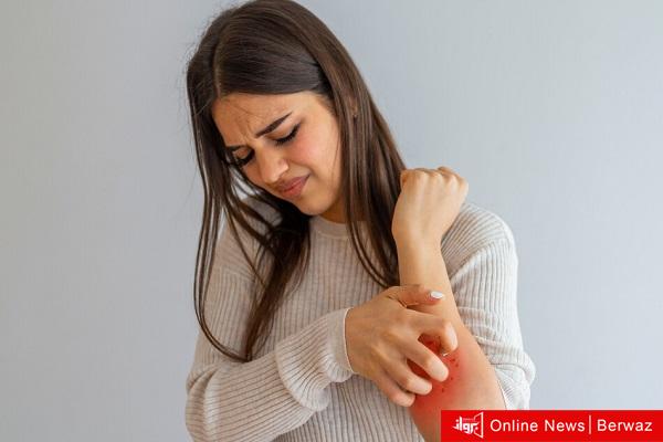 علامات على الجلد تدل على الإصابة بأوميكرون