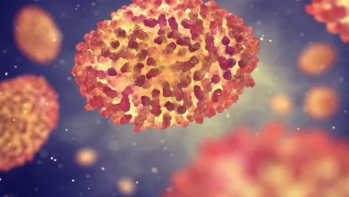 جدري القرود