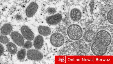 جدري القردة