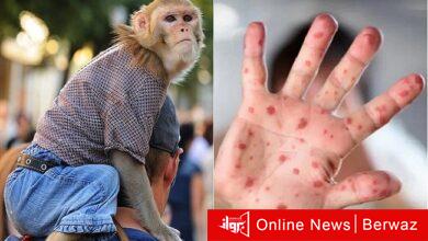 جدري القرود