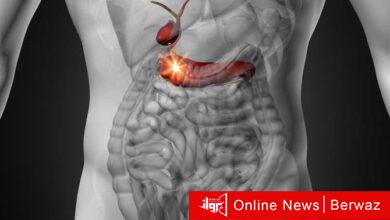 سرطان البنكرياس