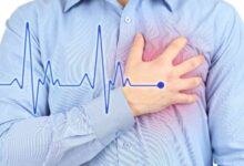 السكتة القلبية