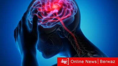 الجلطة الدماغية